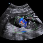 How Accurate are Dog Pregnancy Scans