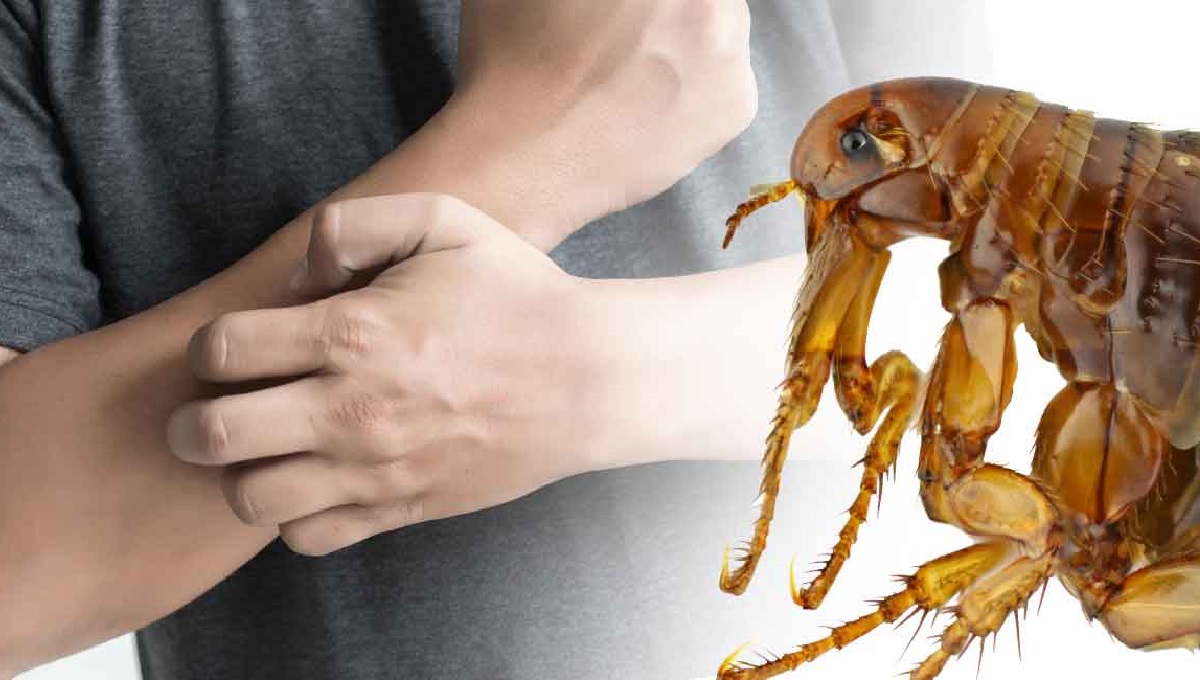 Picture of Can Fleas from Dogs Live on Humans? – Pet Help Reviews UK